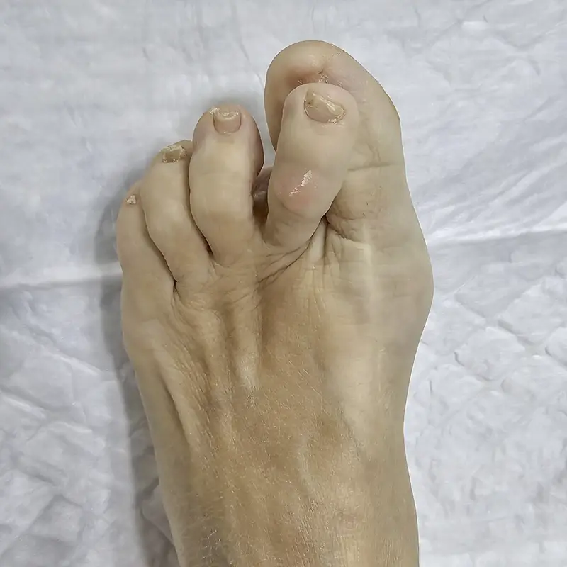 Segundo dedo cruzado (crossover).